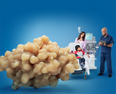 Child on Dialysis