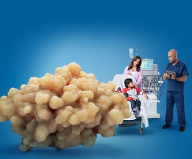 Child on Dialysis